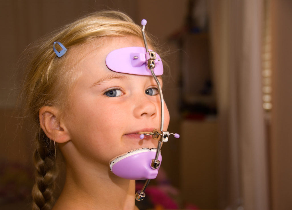 Orthodontic Appliances | Yakima Orthodontics Orthodontic Appliances | Yakima Orthodontics