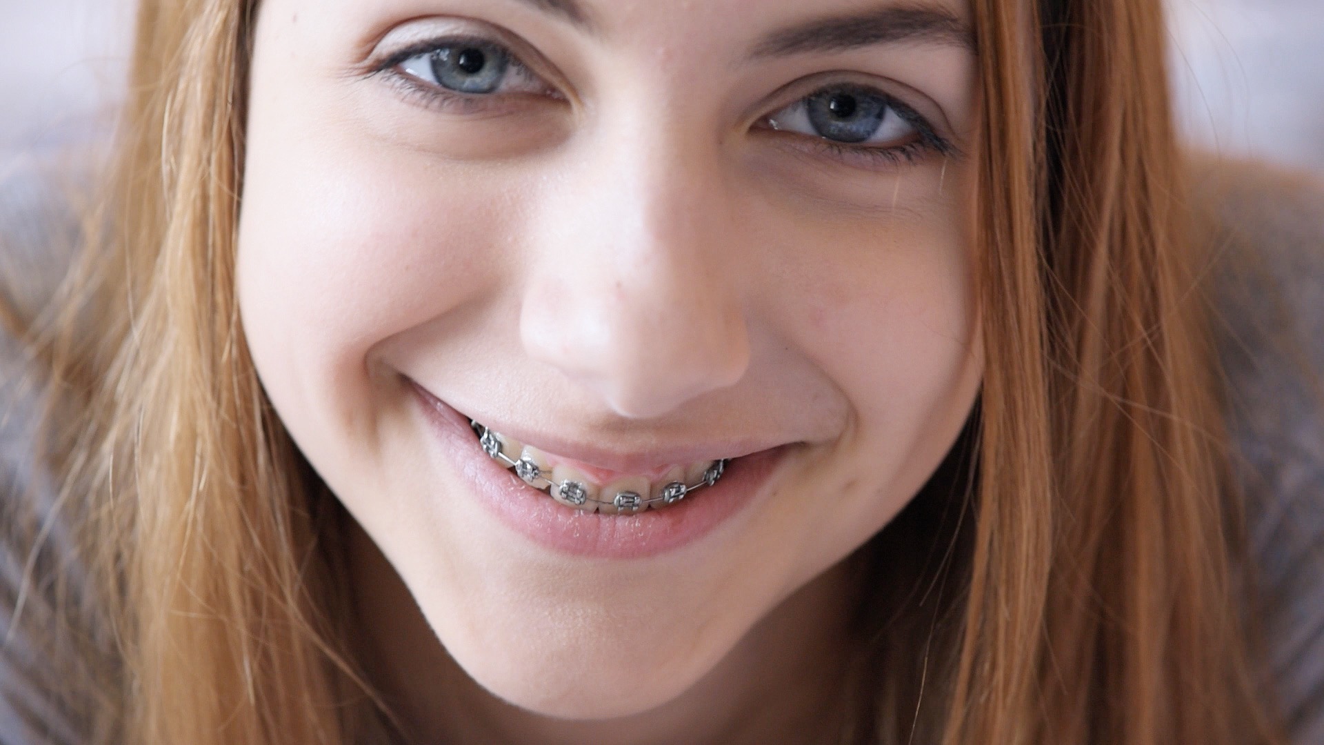 Yakima Ortho Parker Orthodontics