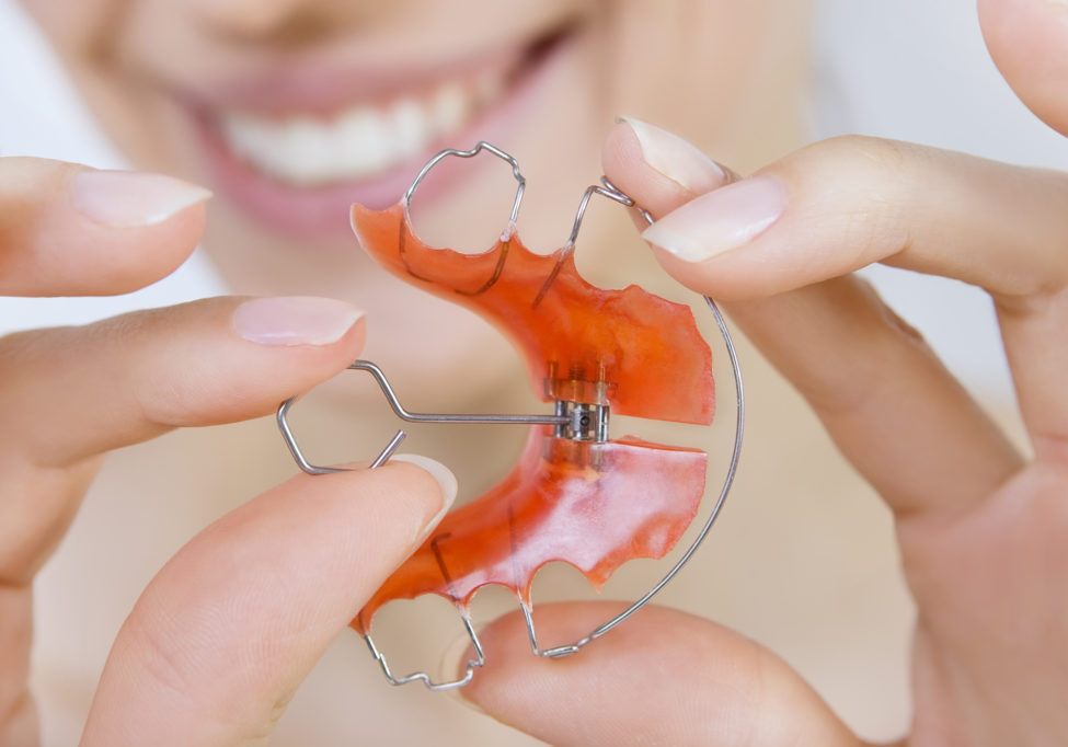 Orthodontic Appliance | Yakima Orthodontics