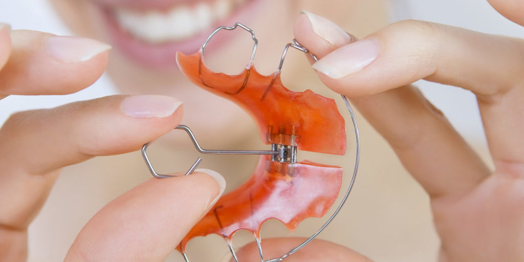 Orthodontic Appliances | Ellensburg Orthodontics WA | Parker Orthodontics Orthodontic Appliances | Ellensburg Orthodontics WA | Parker Orthodontics