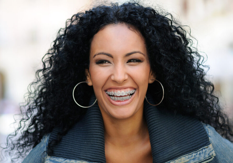 Adult Orthodontics | Yakima Orthodontics Adult Orthodontics | Yakima Orthodontics